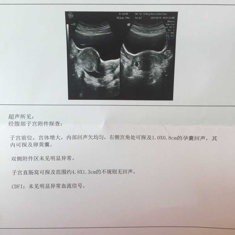 深圳试管婴儿技术怎么样 哪家医院技术最好